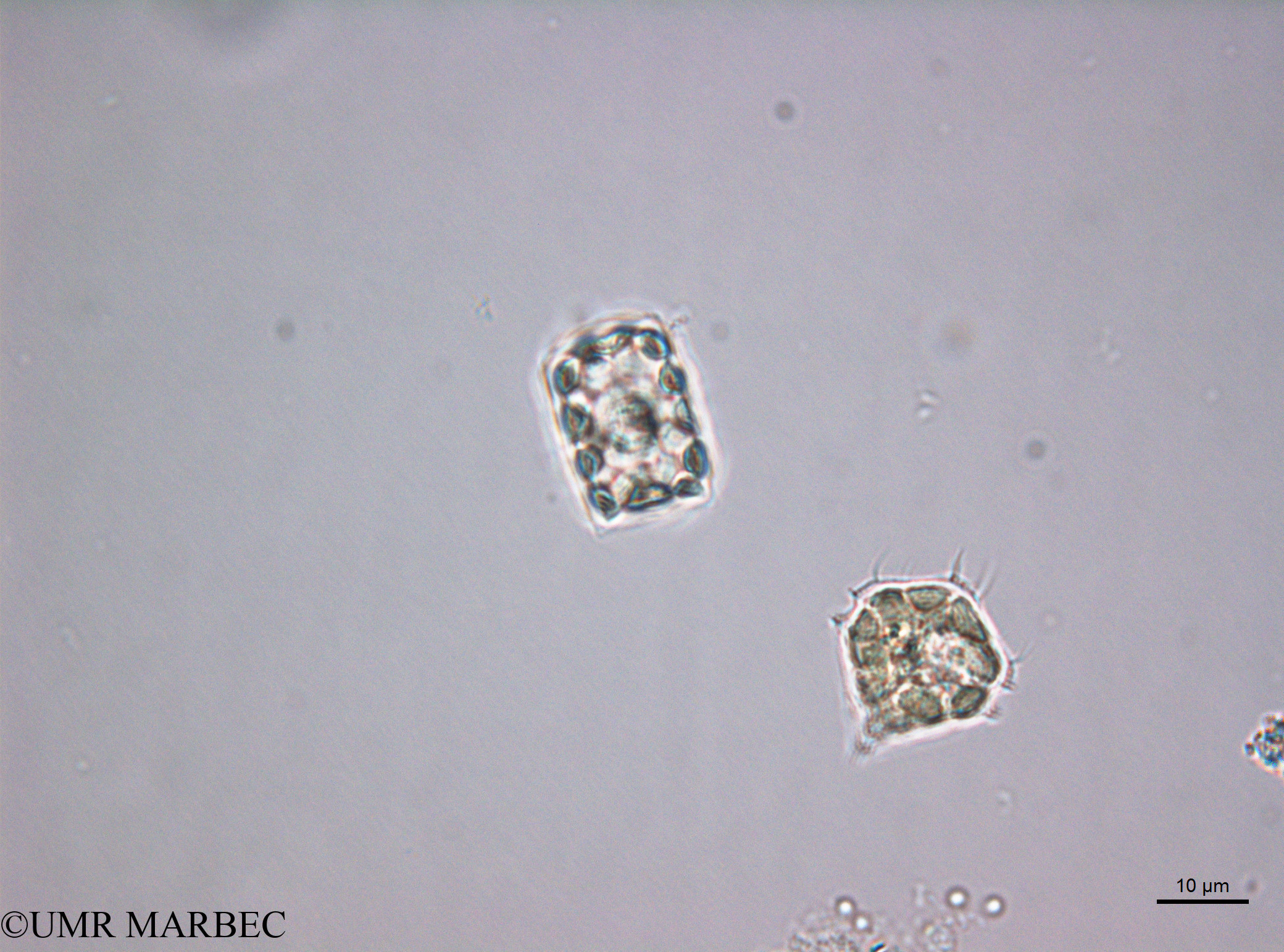 phyto/Scattered_Islands/juan_de_nova/COMMA2 November 2013/Cerataulina sp1 (D5_2_diatomee_ancien_melosira180717_001_ovl-38)(copy).jpg